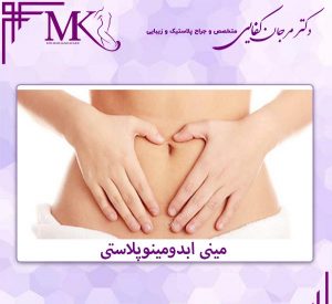 مینی ابدومینوپلاستی