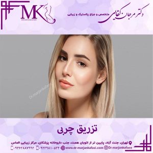 تزریق چربی در تهران- دکتر مرجان کفائی