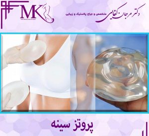 پروتز سینه در تهران