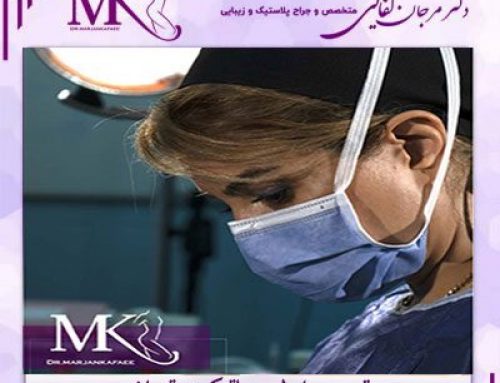 بهترین جراح لیپوماتیک تهران